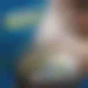 Elektroonikaseadmete avamiskomplekt | OPTIFIX